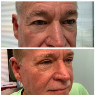 Eyelid Surgeons of Tampa Bay