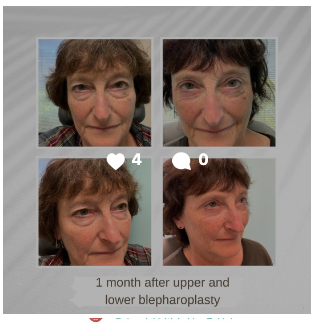 Eyelid Surgeons of Tampa Bay