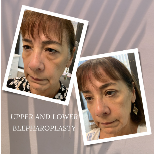 Eyelid Surgeons of Tampa Bay